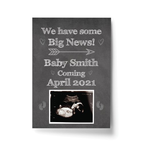 PERSONALISED Scan Image Print Baby Announcement Gift